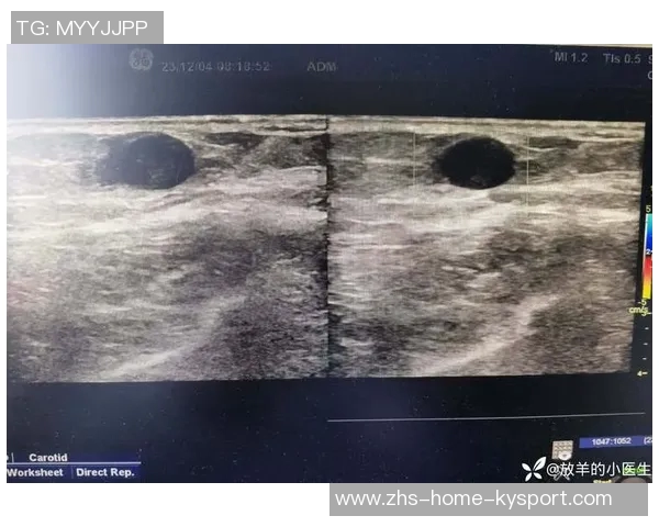 骑士客战绿军梅里尔因右髋部受伤将缺席比赛 骑士客战绿军梅里尔因右髋部受伤将缺席比赛